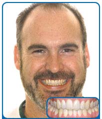 Damon Patient Andrew zeigt stolz seine neuen, geraden Zähne und sein neues Damon Lachen